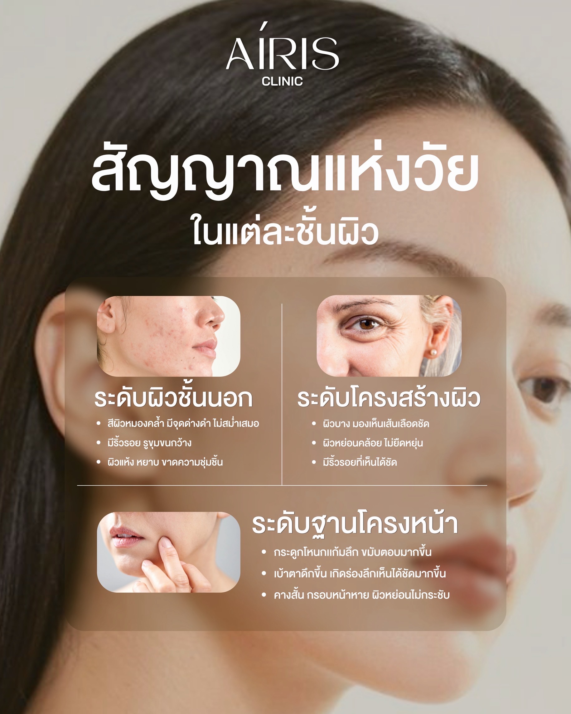 AIRIS Clinic skin education: สัญญาณแห่งวัยในแต่ละชั้นผิว
